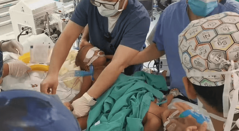 تحضيرات عملية فصل التوأم السيامي في مستشفى الملك عبدالله التخصصي للأطفال